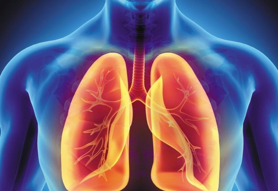 COPD (Lung disease)